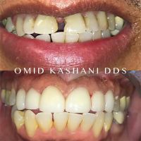 Cosmetic Dental Care of Santa Monica ico