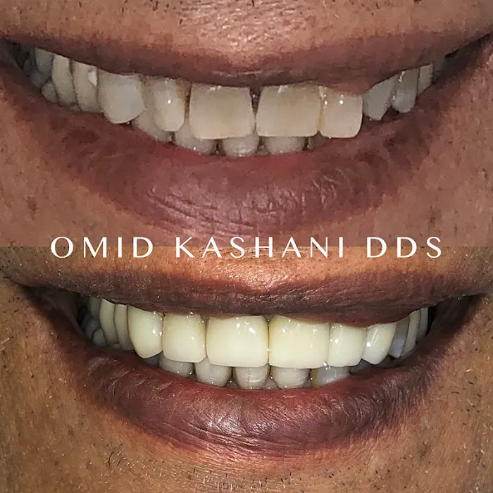 Cosmetic Dental Care of Santa Monica Picture 2