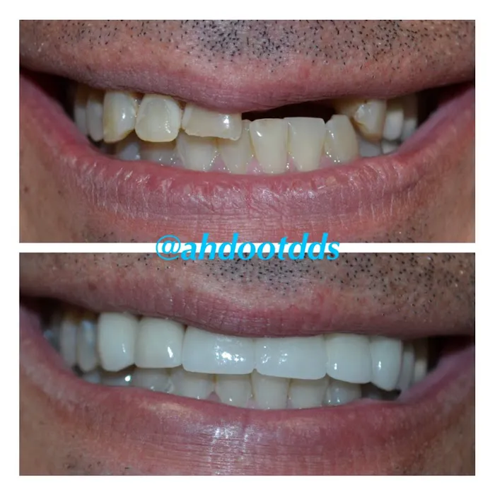 Santa Monica Dental Care Picture 7