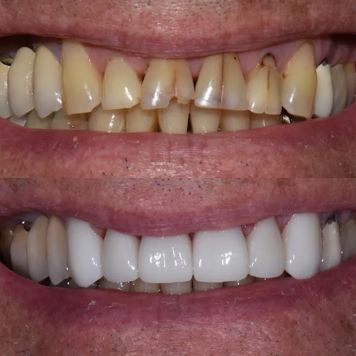 Santa Monica Dental Care Picture 6