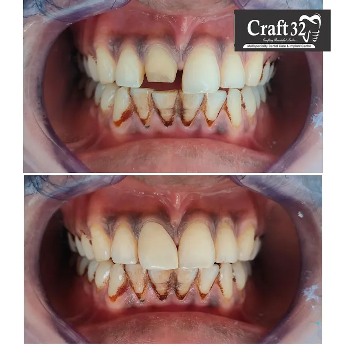 Craft32 Dental Care Picture 10