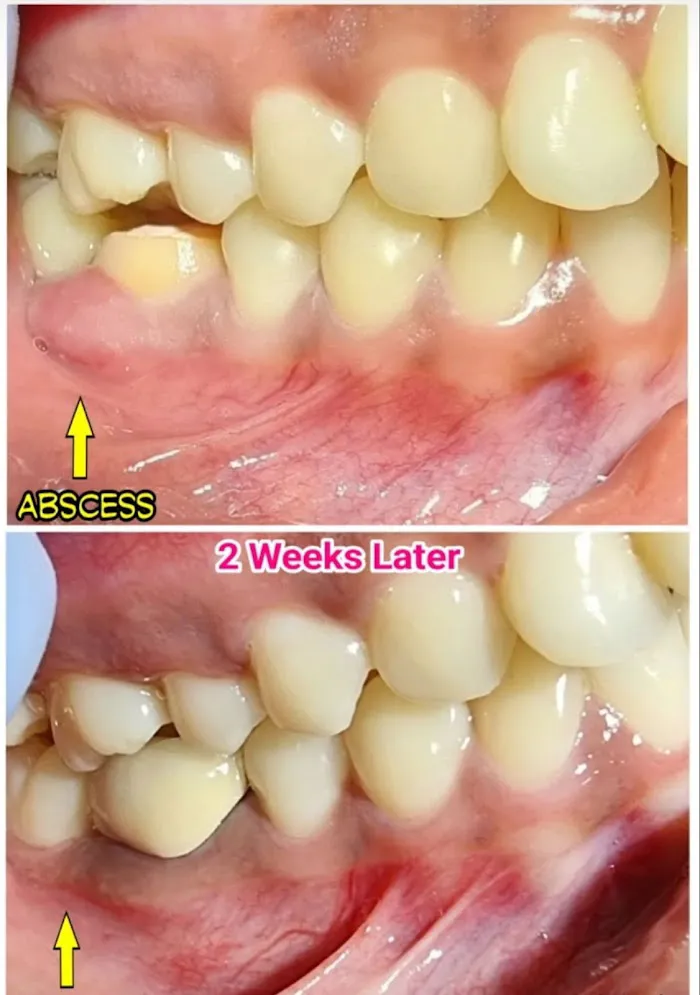 Beaudent Picture 1