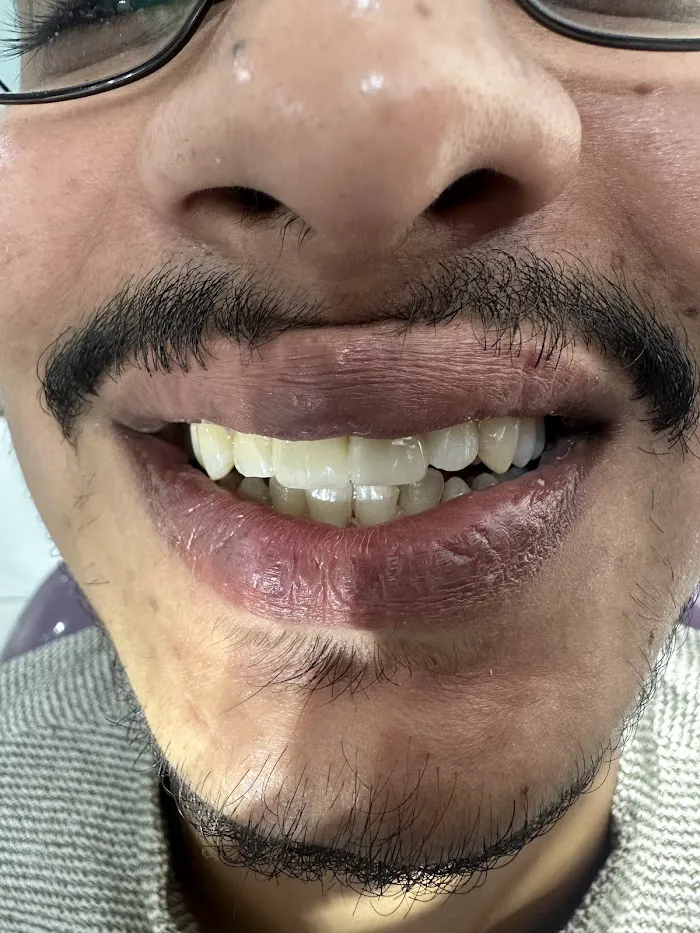 Beaudent Picture 3