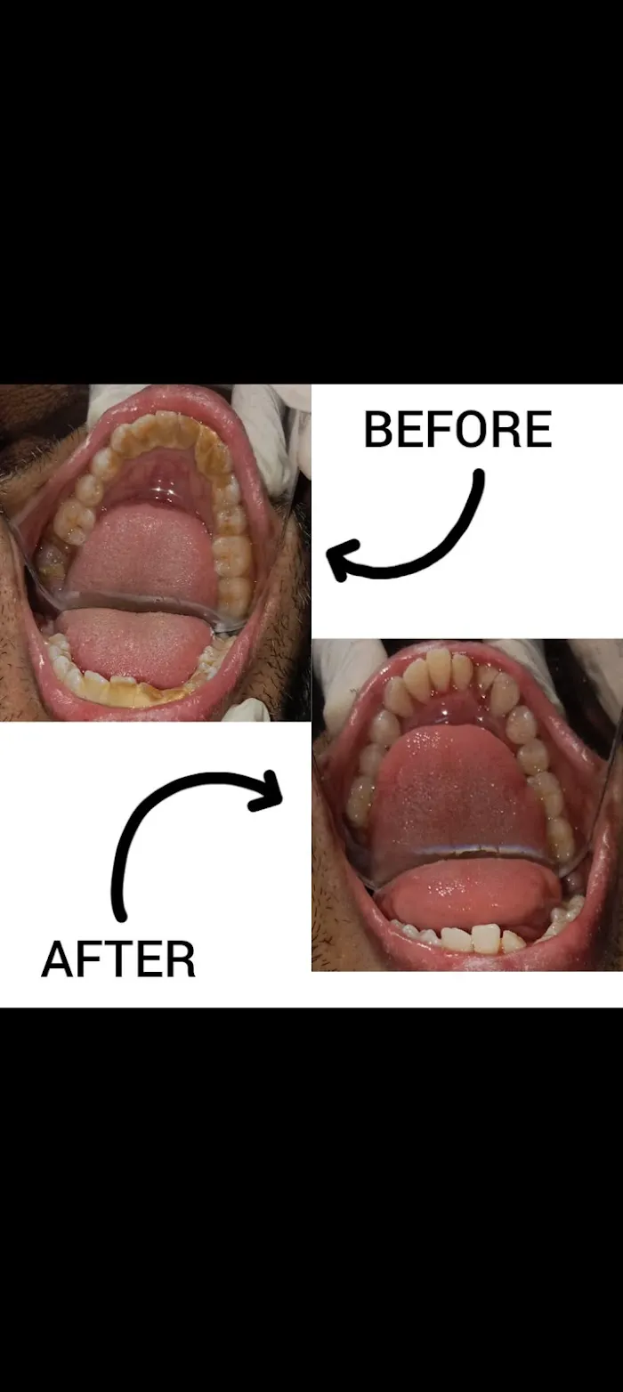 Dent-O-Care Picture 4