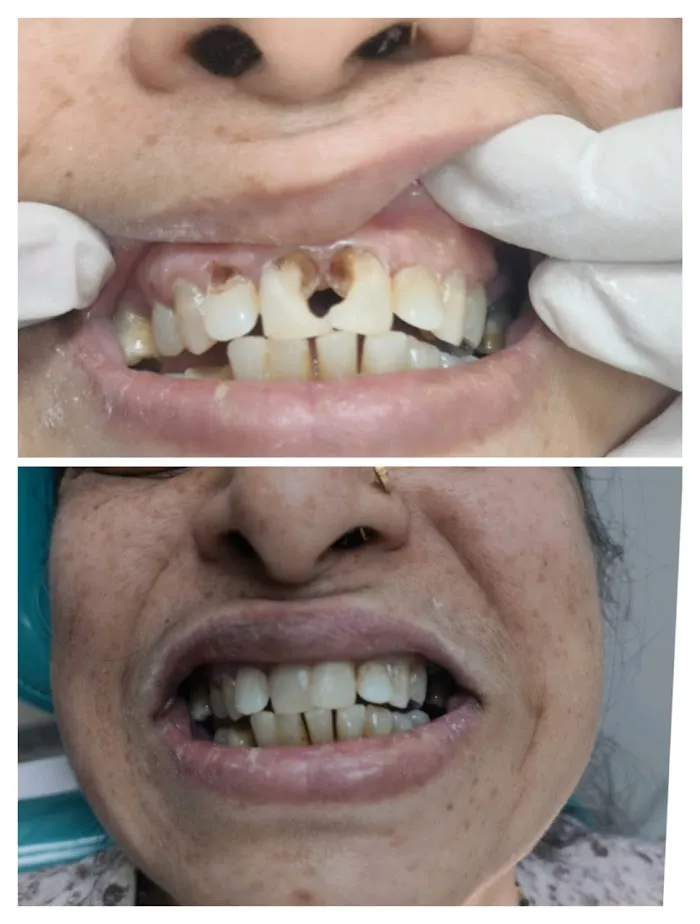 SMILE N CARE MULTI-SPECIALITY DENTAL CLINIC | Best Dental clinic | Dental clinic | Dentist Picture 8