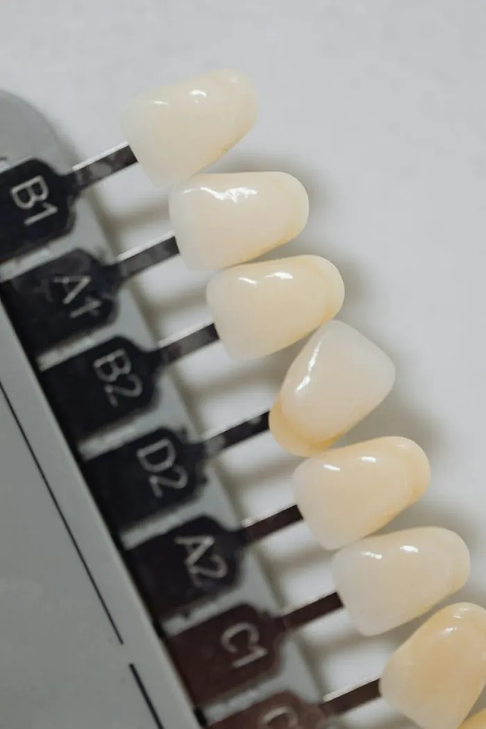SMILE N CARE MULTI-SPECIALITY DENTAL CLINIC | Best Dental clinic | Dental clinic | Dentist Picture 5