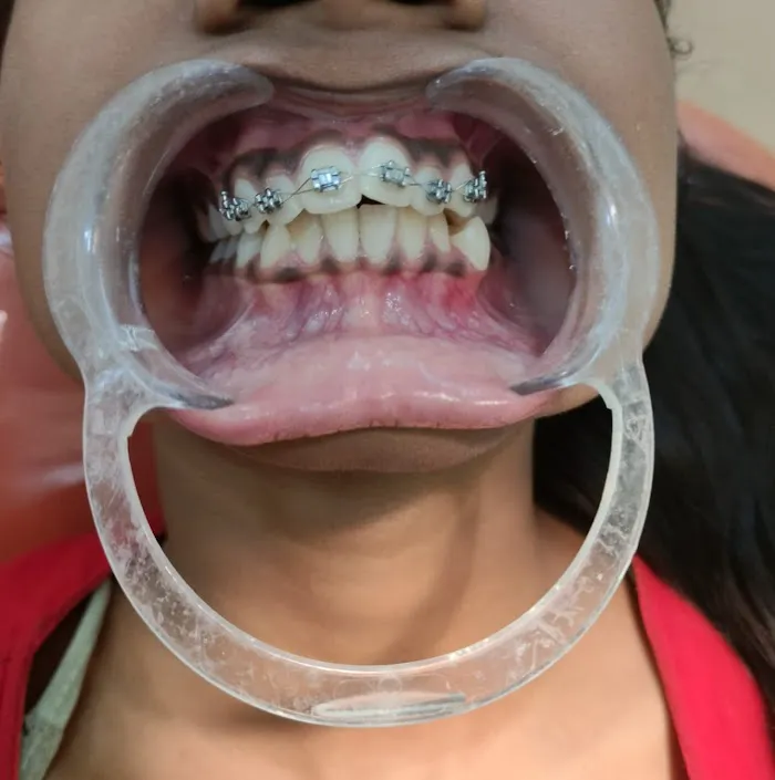 SMILE N CARE MULTI-SPECIALITY DENTAL CLINIC | Best Dental clinic | Dental clinic | Dentist Picture 4