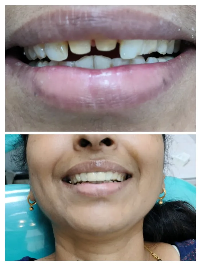 SMILE N CARE MULTI-SPECIALITY DENTAL CLINIC | Best Dental clinic | Dental clinic | Dentist Picture 9
