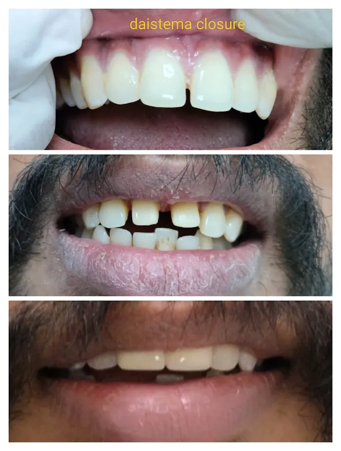 SMILE N CARE MULTI-SPECIALITY DENTAL CLINIC | Best Dental clinic | Dental clinic | Dentist Picture 6