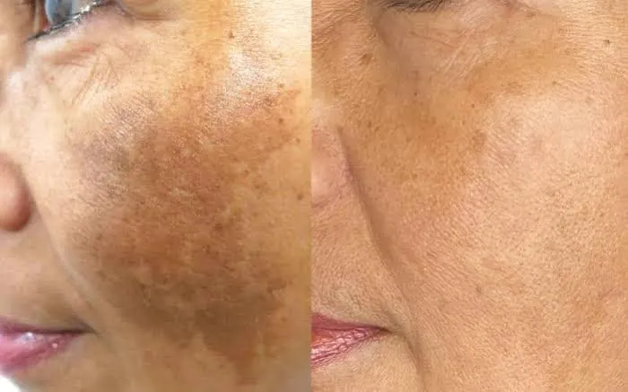 Dr. Shruti's Dent & Derma Clinic Picture 8
