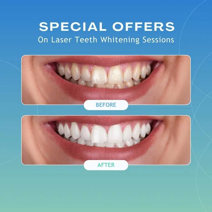 Dr. Smita's Urban Smile - Dental Clinic In Hinjawadi | Best Dental In Hinjewadi Root Canal, Aligners, Braces, Implants, Picture 3