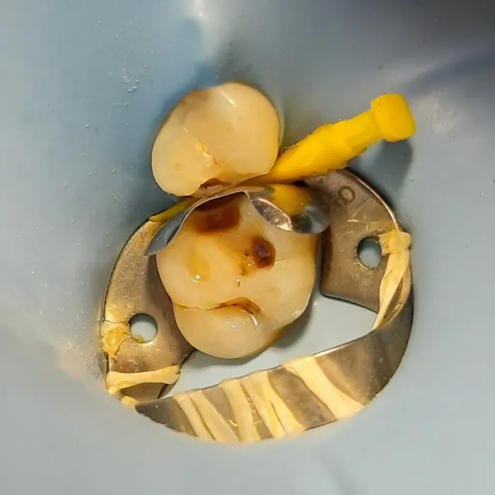 DenTown Dental Clinic Picture 7