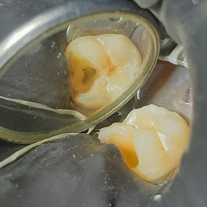 DenTown Dental Clinic Picture 10