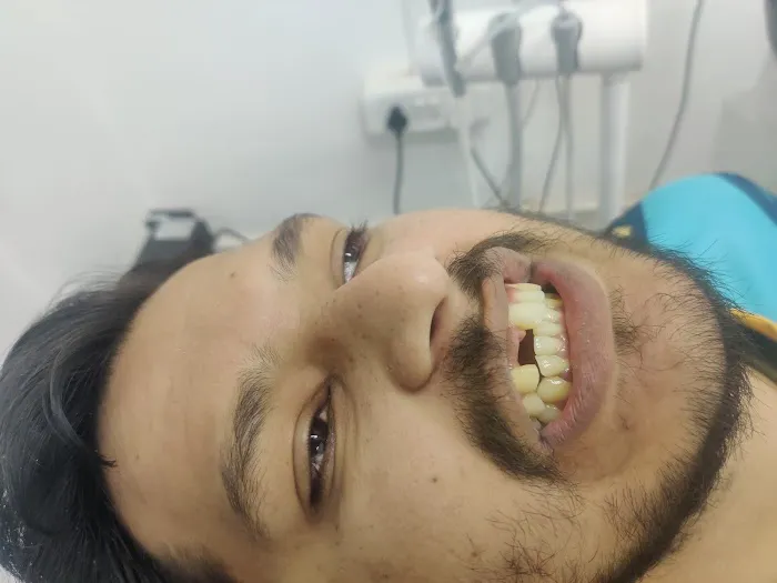 Wellness Dental clinic best dentist | Dr sangeetha| aligners , implant ,vaneers,root canal |RCT| best dental clinic wakad Picture 5