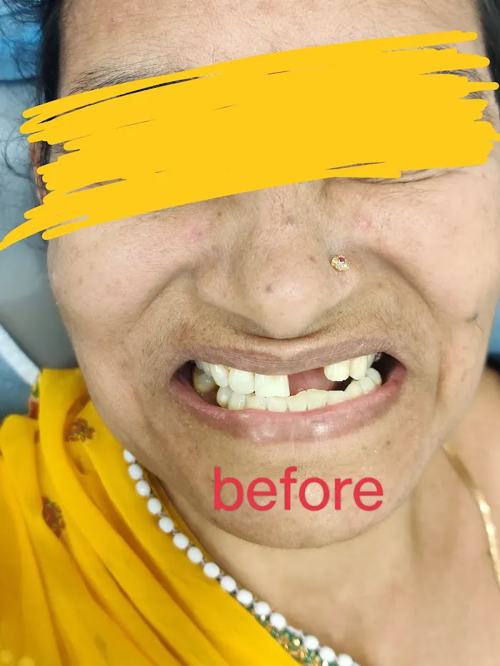 Wellness Dental clinic best dentist | Dr sangeetha| aligners , implant ,vaneers,root canal |RCT| best dental clinic wakad Picture 6