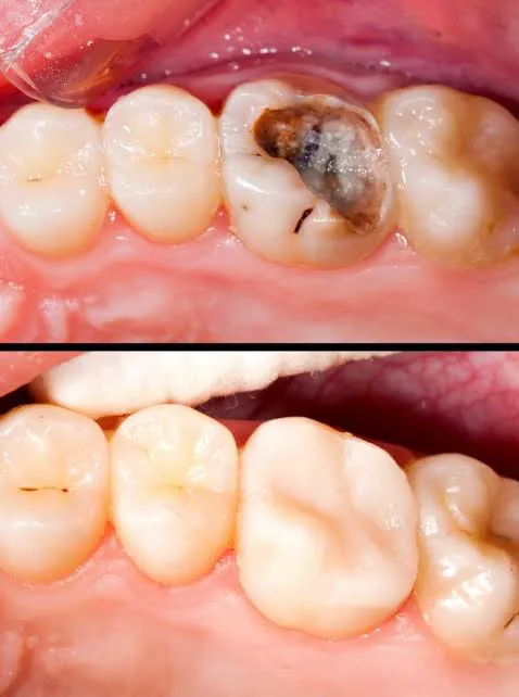 Wellness Dental clinic best dentist | Dr sangeetha| aligners , implant ,vaneers,root canal |RCT| best dental clinic wakad Picture 9