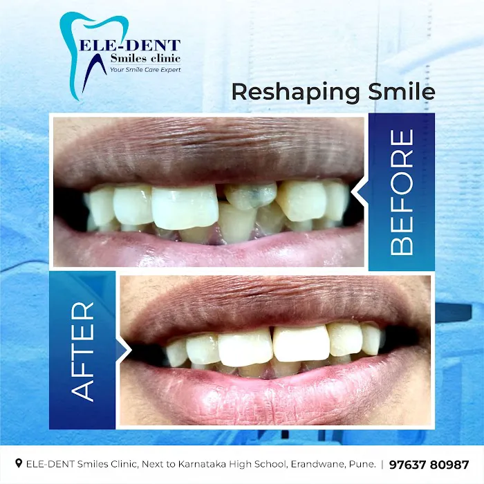 ELE-DENT Smiles Dental Clinic Picture 6