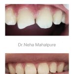 ELE-DENT Smiles Dental Clinic