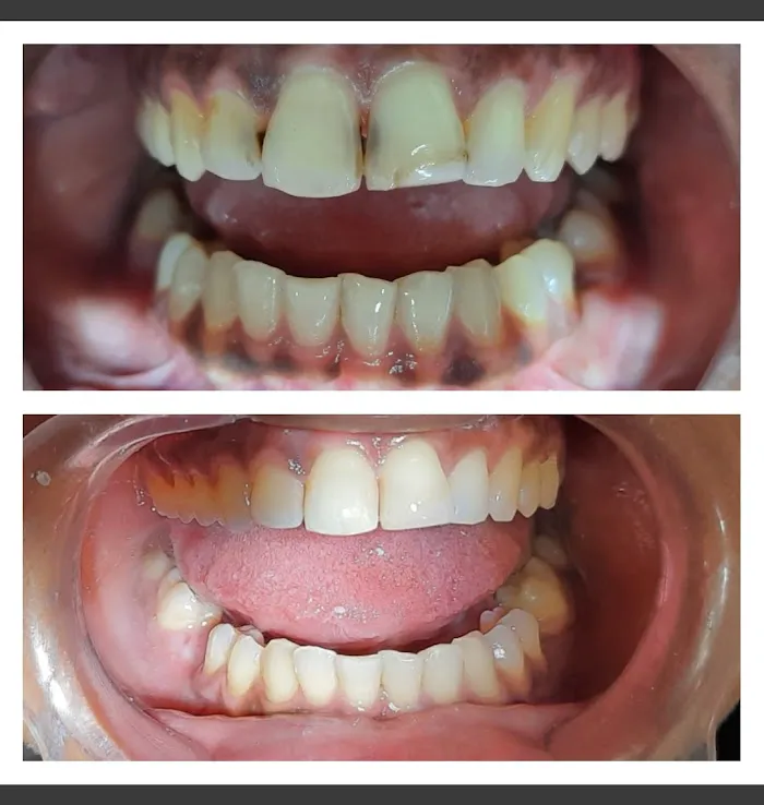 TOOTHBOOTH Dr.Kalyani's Dental Clinic Picture 3