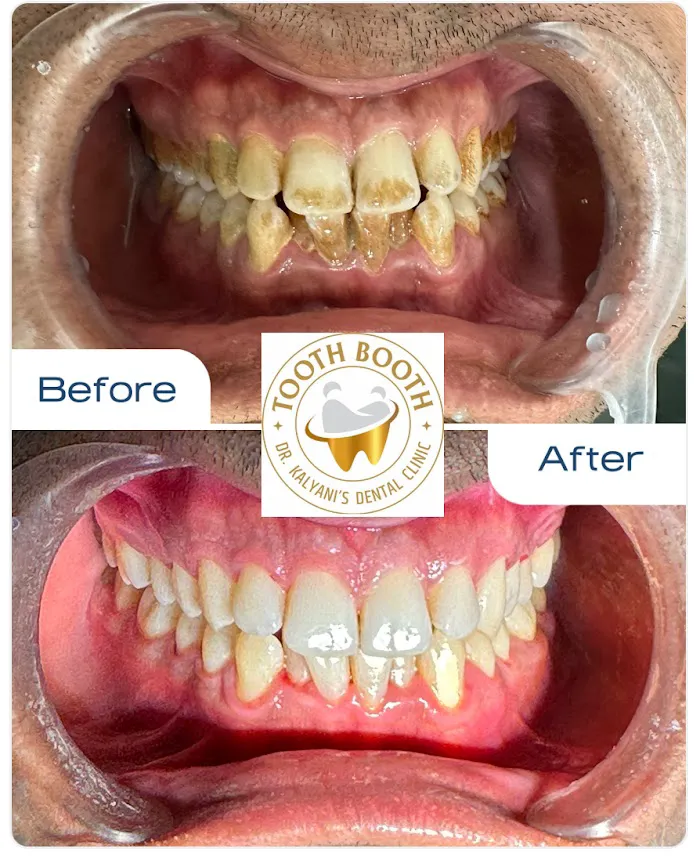 TOOTHBOOTH Dr.Kalyani's Dental Clinic Picture 8