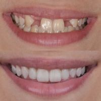 Dental Studio ico