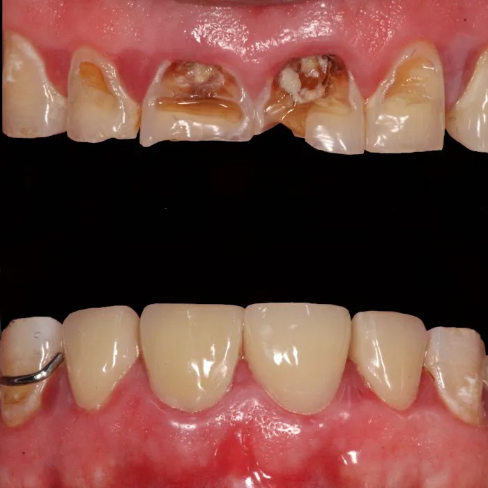 Edent Clinica Dental Picture 4