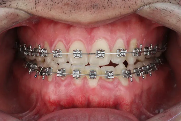 Edent Clinica Dental Picture 3