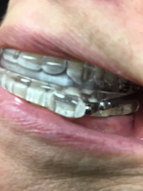 Sleep Better Lenexa Picture 4