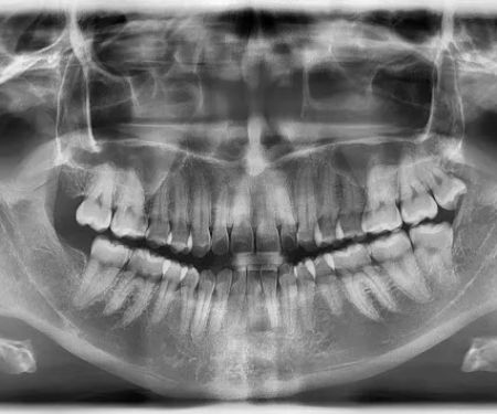 Dental Del Angel