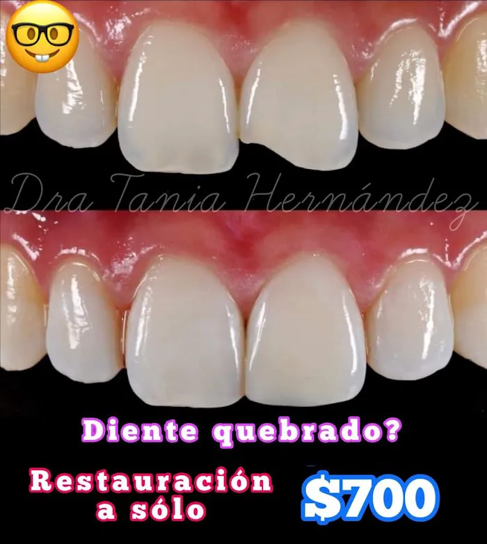 Odonto Promos Salud Dental Dra Anaid Hernandez Picture 7