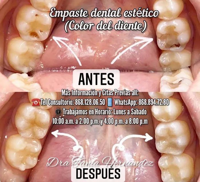 Odonto Promos Salud Dental Dra Anaid Hernandez Picture 9