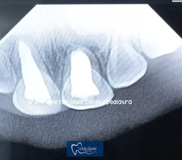 Dra. Arlene Ter-Veen Odontopediatra White Studio Dental Care Picture 2