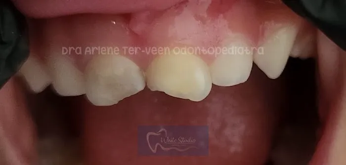 Dra. Arlene Ter-Veen Odontopediatra White Studio Dental Care Picture 3
