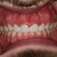 Hope Dental ico