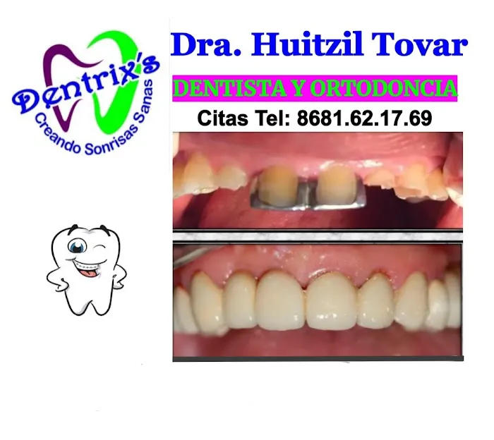 Dentrixs Dentista. Dra. Huitzil Tovar Ortodoncista Picture 1