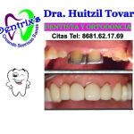 Dentrixs Dentista. Dra. Huitzil Tovar Ortodoncista