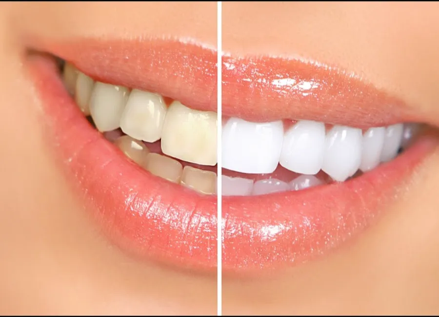 Bright Smile Family Dental Picture 1