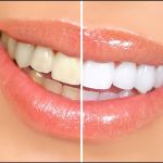Bright Smile Family Dental