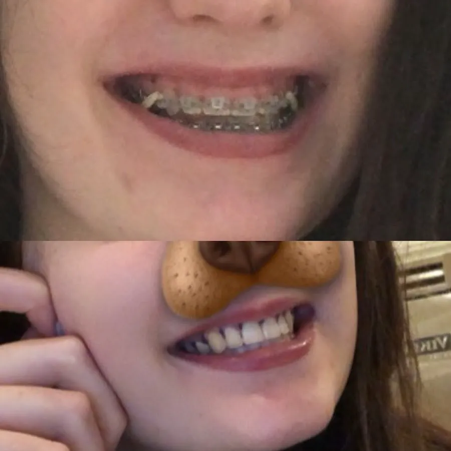 Western Dental Group: Dr. Simona Katona DDS Picture 4