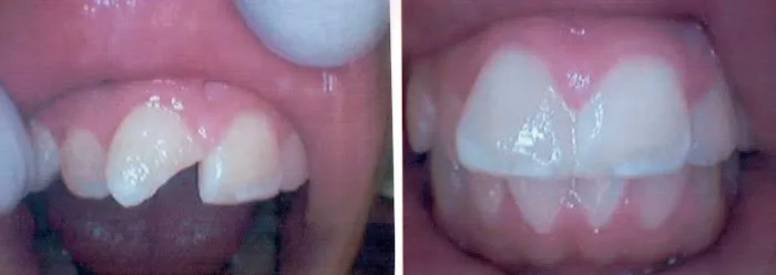 Los Ebanos Family Dentistry: Dr Lillian Adame Nelson Picture 4