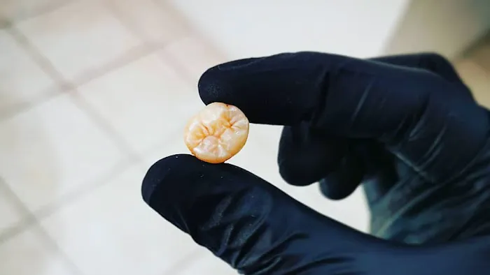 Esthetic Dent Picture 3