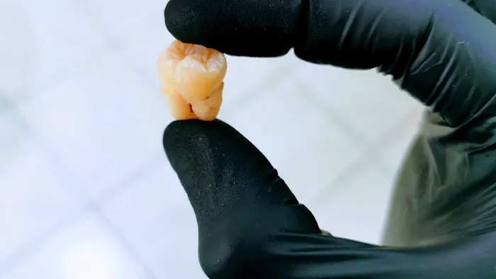 Esthetic Dent Picture 5