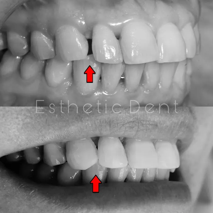 Esthetic Dent Picture 4