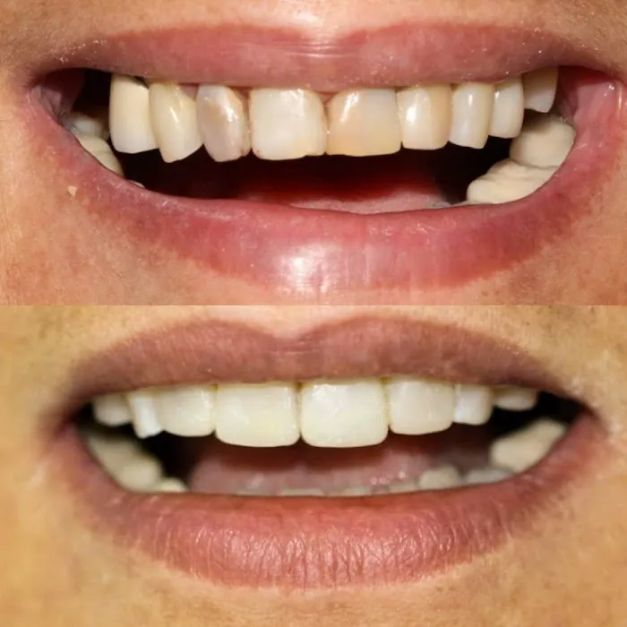 Dentista Buco dent Picture 8