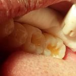 consultorio dental villa las torres