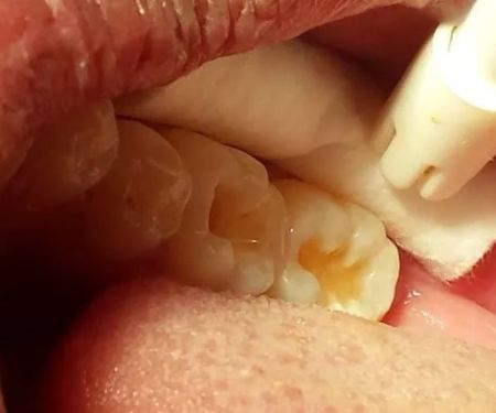 consultorio dental villa las torres