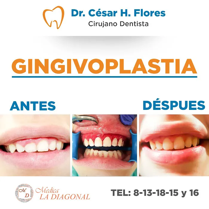Dr. César Hernán Flores Flores Picture 2