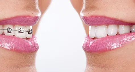 Dentistry for You Picture 7