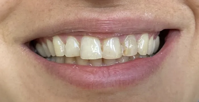 Clovedent Family Dentistry Picture 5