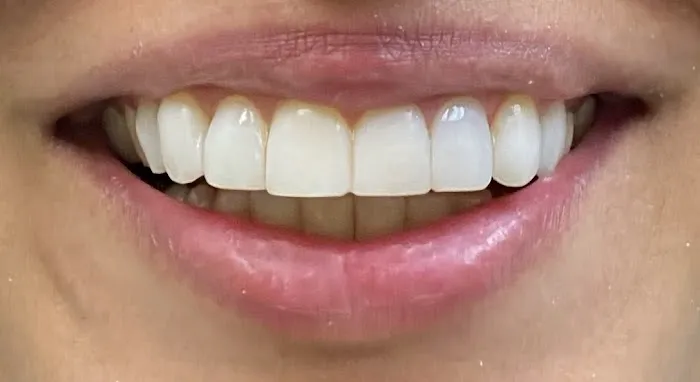 Clovedent Family Dentistry Picture 4